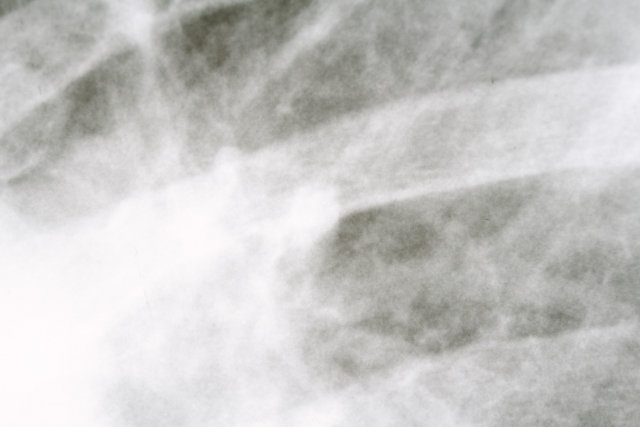 【人体の雑学】バリウムを飲んだ後に下剤を飲むのはなぜ？ GakuSha